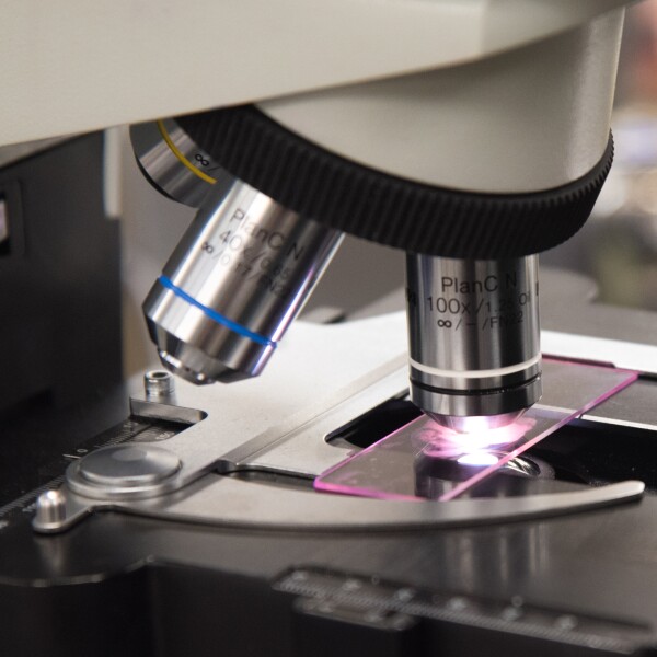A gram-stained specimen slide on a microscope.