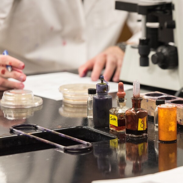 Student recording microscope slide results.